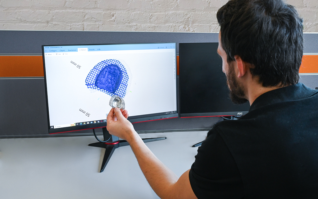 Dental CAD/CAM Vergleich zentrale o. dezentrale Fertigung? Mindfab